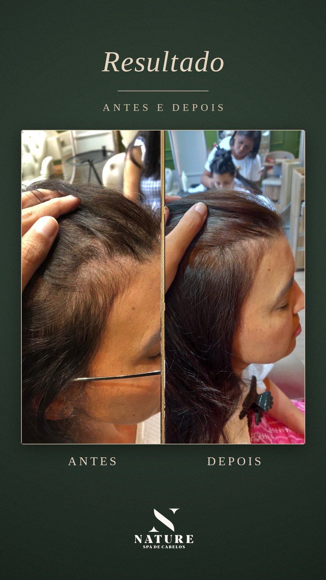 Antes e Depois 2
